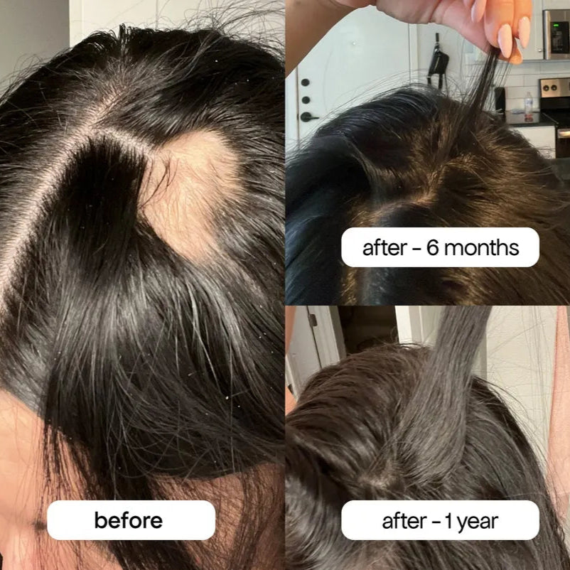 Rosemary Infusion Shampoo™
