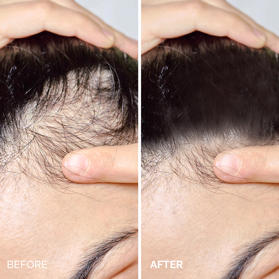 Rosemary Infusion Shampoo™